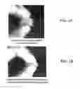 Fig. 02 - DEMINERALIZED BONE MATRIX