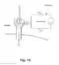 Fig. 09 - Filter interface for multimodal surgical gas delivery system