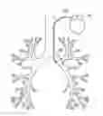 Fig. 01 - Systems and methods for delivering pulmonary therapy