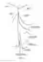 Fig. 05 - Systems and methods for delivering pulmonary therapy