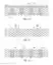 Fig. 13 - Systems and methods for delivering pulmonary therapy