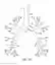 Fig. 17 - Systems and methods for delivering pulmonary therapy