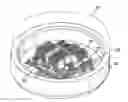 Fig. 01 - Package for an implantable neural stimulation device