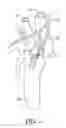Fig. 02 - SYSTEMS AND METHODS FOR SELECTIVE STIMULATION OF NERVE FIBERS IN CAROTID SINUS