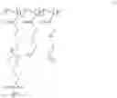 Fig. 30 - Composite membranes and methods of preparation thereof