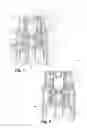 Fig. 02 - Applicator head for a dispenser, as well as a dispenser comprising such an applicator head