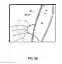 Fig. 09 - Trim assembly