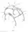 Fig. 02 - Lifting bale