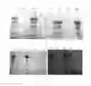 Fig. 02 - Method for isolating and purifying recombinant human serum albumin from transgenic rice grain
