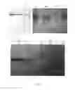 Fig. 05 - Method for isolating and purifying recombinant human serum albumin from transgenic rice grain