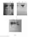 Fig. 06 - Method for isolating and purifying recombinant human serum albumin from transgenic rice grain