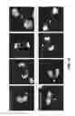 Fig. 23 - FUSION PROTEINS AND METHODS THEREOF