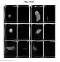 Fig. 08 - PRODUCTION OF BETA-CELLS