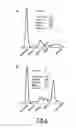 Fig. 07 - Protein microarray for characterizing the specificity of the monoclonal immunoglobulins of MGUS or myeloma patients