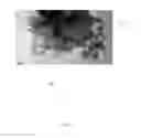 Fig. 08 - Urinary Crystal Detection System and Method Thereof