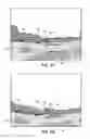 Fig. 11 - Eyepiece for variable lateral magnification imaging system