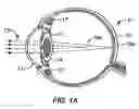Fig. 02 - Single microstructure lens, systems and methods