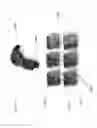 Fig. 42 - EYE IMAGING IN HEAD WORN COMPUTING