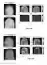 Fig. 13 - MULTISPECTRAL IMAGING BIOMETRICS