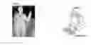 Fig. 01 - Object tracking method and device