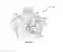 Fig. 02 - SYSTEMS, METHODS AND COMPUTER READABLE STORAGE MEDIA STORING INSTRUCTIONS FOR INTEGRATING FLUOROSCOPY VENOGRAM AND MYOCARDIAL IMAGES