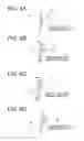 Fig. 07 - Infrared imaging system