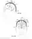 Fig. 44 - Composite RF current attenuator for a medical lead
