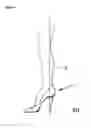 Fig. 08 - Proper posture high-heeled shoes