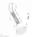 Fig. 03 - Image-based feedback endoscopy system
