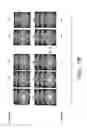 Fig. 10 - Image-based feedback endoscopy system