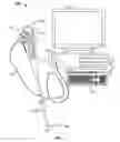 Fig. 02 - Method and system for eliminating image motion blur in a multiple viewing elements endoscope