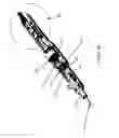 Fig. 06 - Balloon atherectomy catheters with imaging