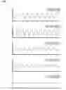 Fig. 08 - PULSE WAVE SENSOR