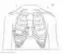 Fig. 01 - Method for ECG lead placement changes to be accurately accounted for