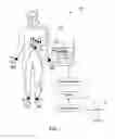 Fig. 02 - Method for ECG lead placement changes to be accurately accounted for