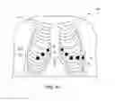 Fig. 07 - Method for ECG lead placement changes to be accurately accounted for