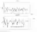 Fig. 07 - Heart rate correction system and methods for the detection of cardiac events