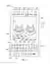 Fig. 08 - Methods and systems for display of shear-wave elastography  and strain elastography images