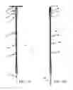 Fig. 02 - DEVICE AND METHOD FOR SEALING BLOOD VESSELS