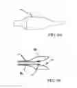 Fig. 07 - DEVICE AND METHOD FOR SEALING BLOOD VESSELS