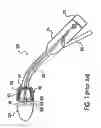 Fig. 02 - Electromechanical drive and remote surgical instrument attachment having computer assisted control capabilities