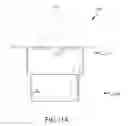 Fig. 14 - Tissue separating systems and methods