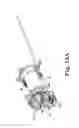Fig. 11 - ROTATIONAL ATHERECTOMY SYSTEMS AND METHODS WITH SHOCK ABSORBING ELEMENT