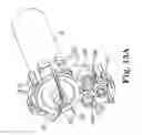 Fig. 17 - ROTATIONAL ATHERECTOMY SYSTEMS AND METHODS WITH SHOCK ABSORBING ELEMENT