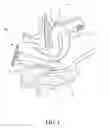 Fig. 02 - Vaginal endoscopic port unit module