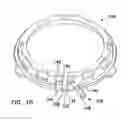 Fig. 07 - Hand access laparoscopic device