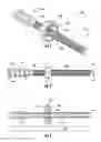 Fig. 02 - System and method for reducing and stabilizing a bone fracture