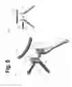 Fig. 06 - Method and device for restabilization with axial rotation of the atlantoaxial junction