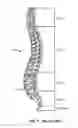 Fig. 02 - Implantable orthopedic device component selection instrument and methods