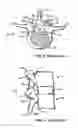 Fig. 03 - Implantable orthopedic device component selection instrument and methods